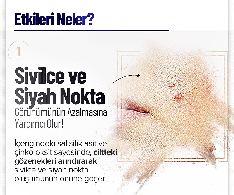 Giorgio Di Mare Akne Karşıtı Set - Görsel 3